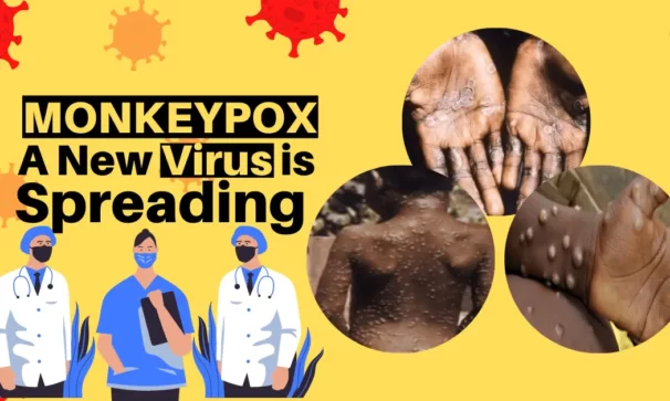 What is Monkeypox and how severe it is?